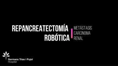 Repancreatectomía robótica por metastasis de carcinoma renal