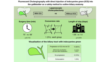 Fluorescent cholangiography with direct injection of indocyanine green (ICG) into the gallbladder: a safety method to outline biliary anatomy.