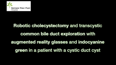 Robotic common bile duct exploration