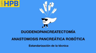 Anastomosis Pancreática Robótica