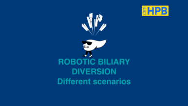 Robotic Biliary Diversion, different scenarios